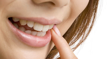 歯のくすみが顔全体の印象を暗くする
